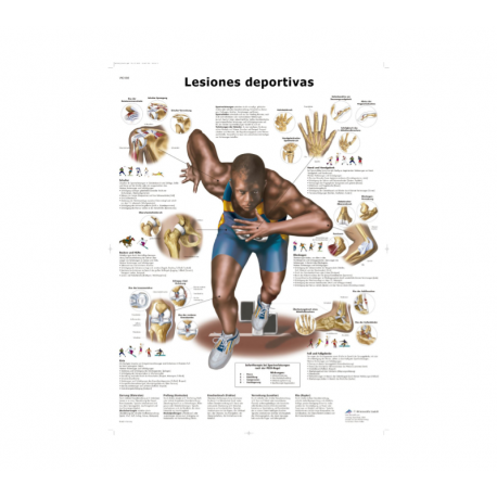 Lámina Lesiones Deportivas