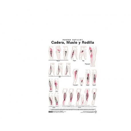Lámina Puntos Gatillo Cadera, Muslo y Rodilla