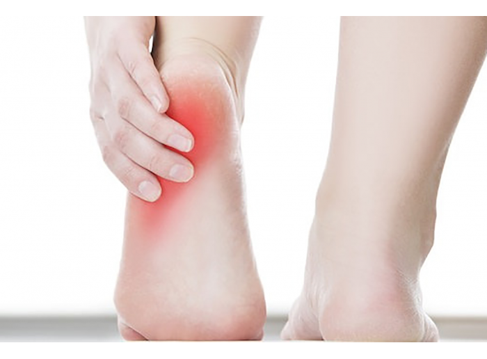 FASCITIS PLANTAR.- ¿Qué es?, causas, diagnósticos y tratamientos.